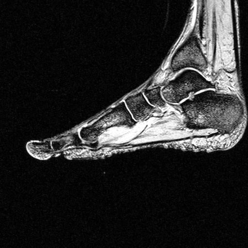 Rezonans magnetyczny stopy